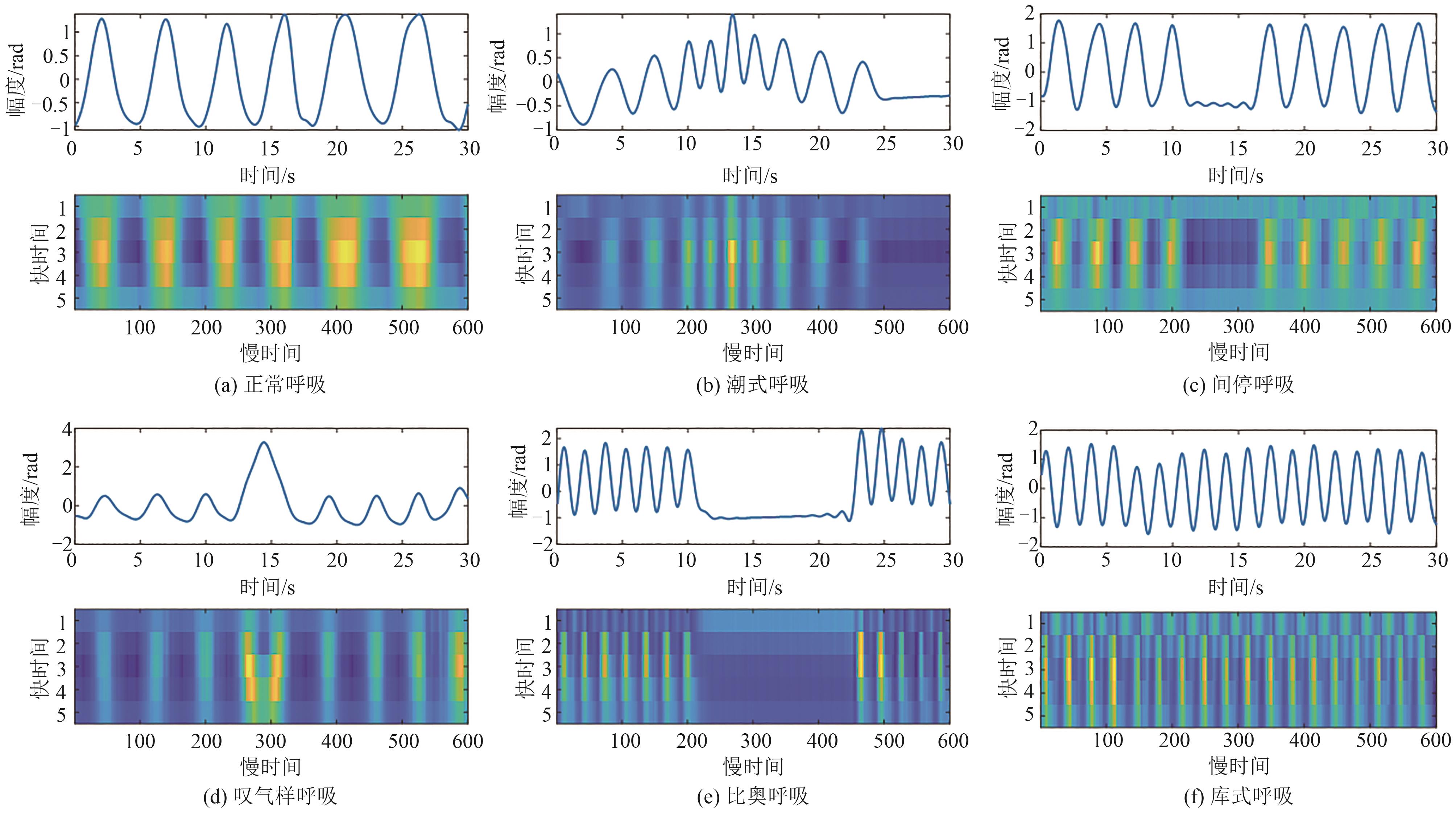 呼吸波形的波峰波谷搜寻